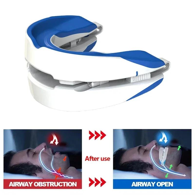 Adjustable Anti-Snoring Mouthpiece